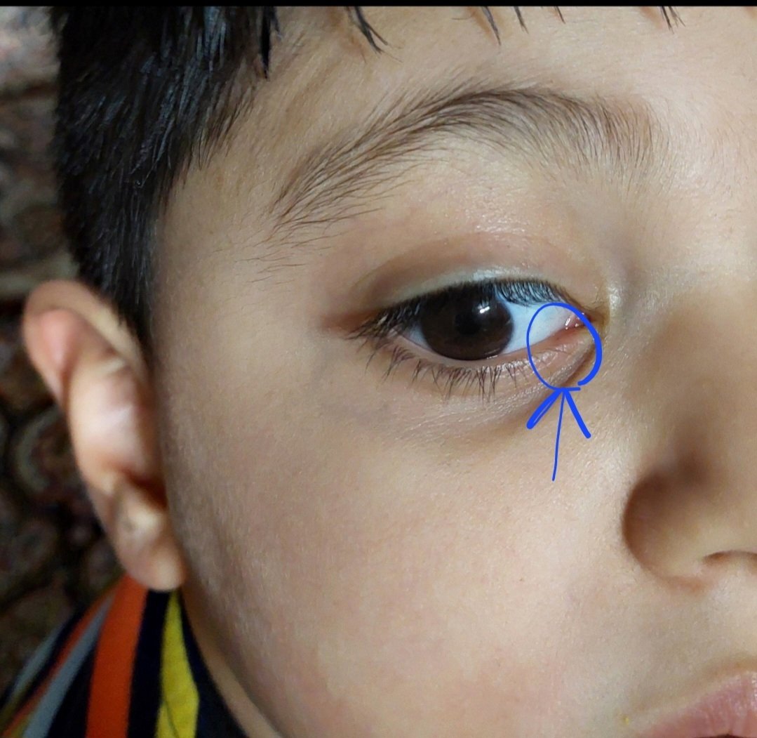 این قسمت چشمش این قسمت چشمش