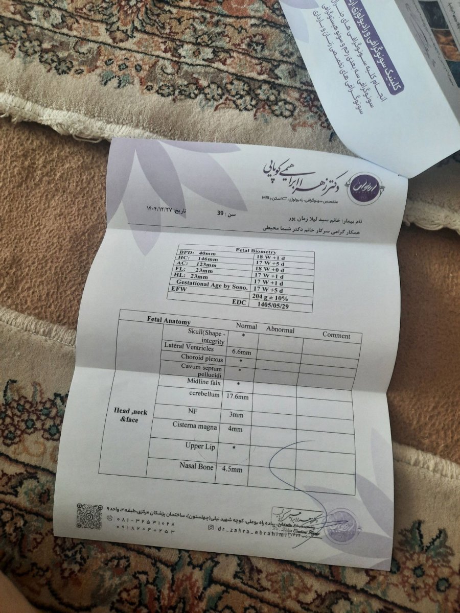 💞سلام تفسیر سونوی آنومالی💞