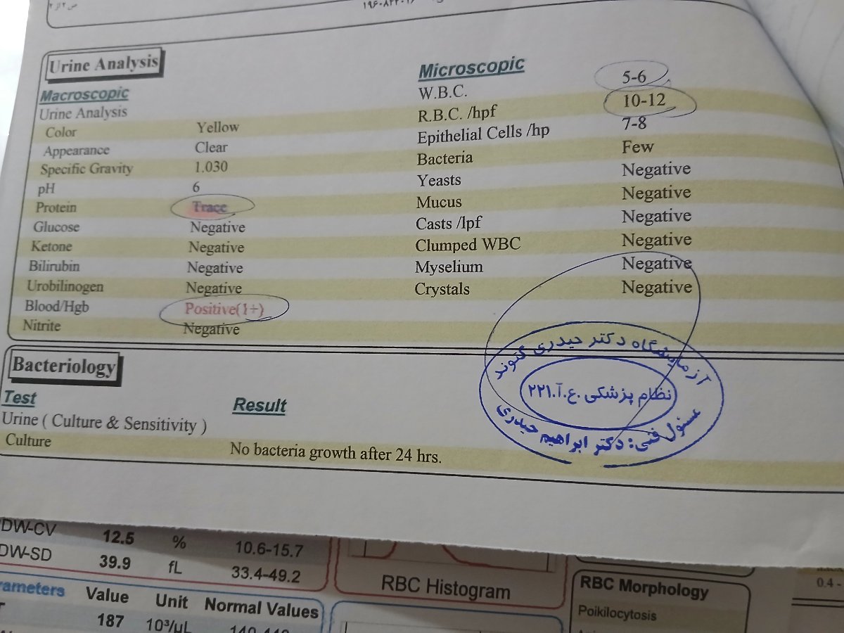 اورژانسی!تفسیر آزمایش هفت ماهگی اورژانسی!تفسیر آزمایش هفت ماهگی
