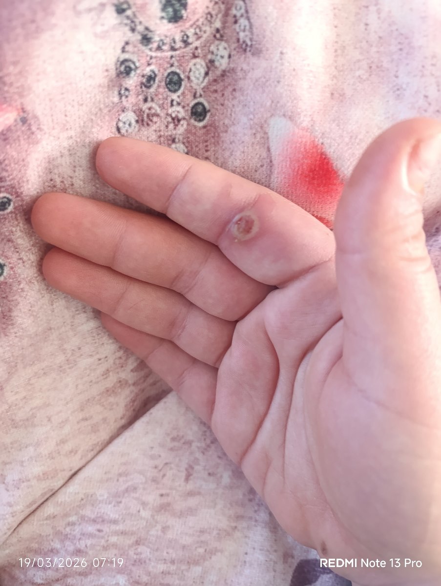 خانم دکتر دستم سوخته +عکس خانم دکتر دستم سوخته +عکس