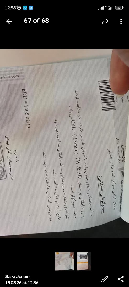 رابطه در اوایل بارداری