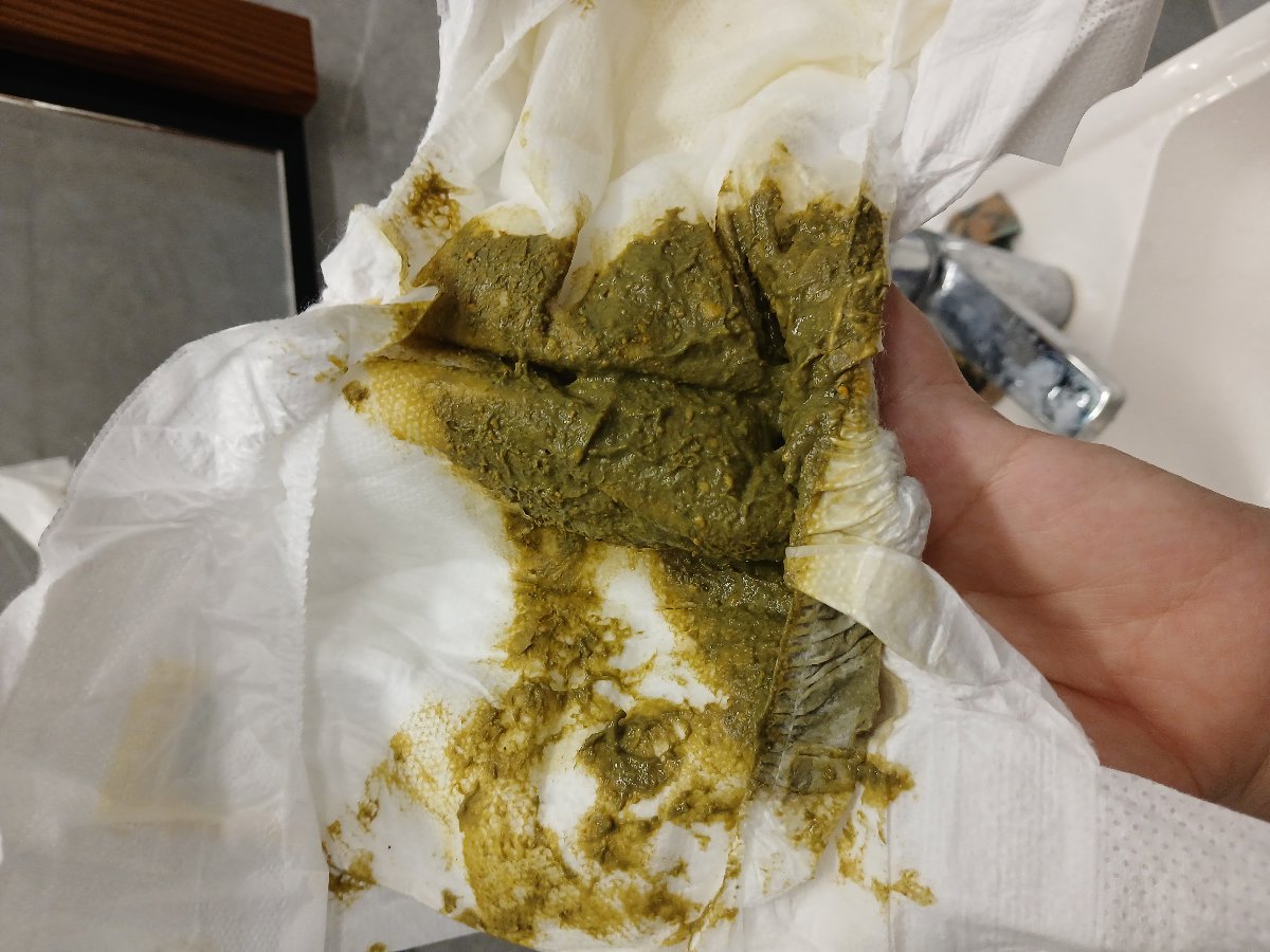 مدفوع سبز نوزاد ۴۵روزه مدفوع سبز نوزاد ۴۵روزه