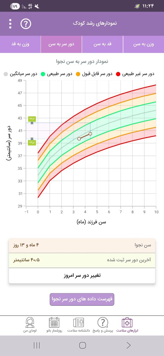 دور سر نوزاد چهارماهه