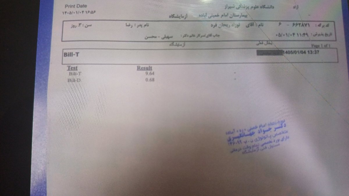 زردی نوزاد ۴ روزه زردی نوزاد ۴ روزه