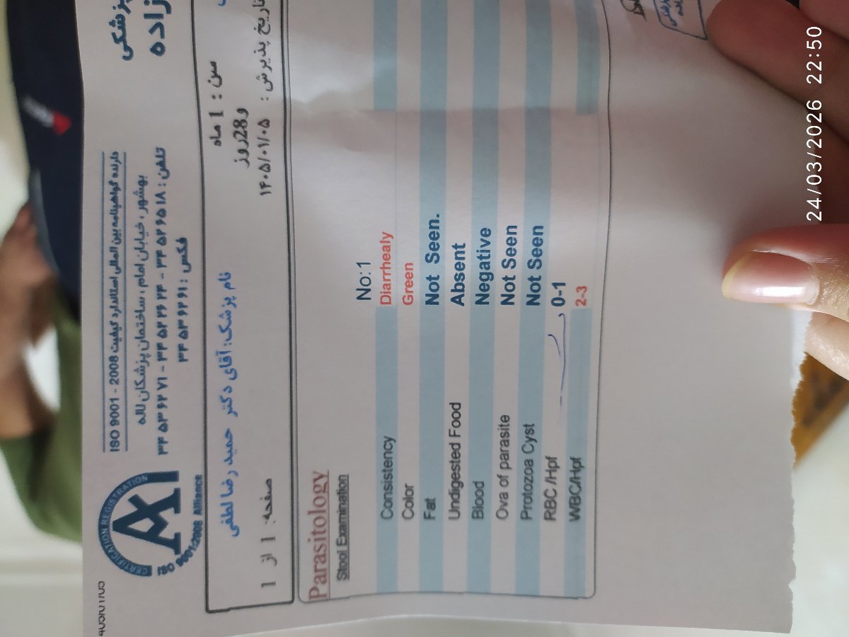 حساسیت ب لاکتوز