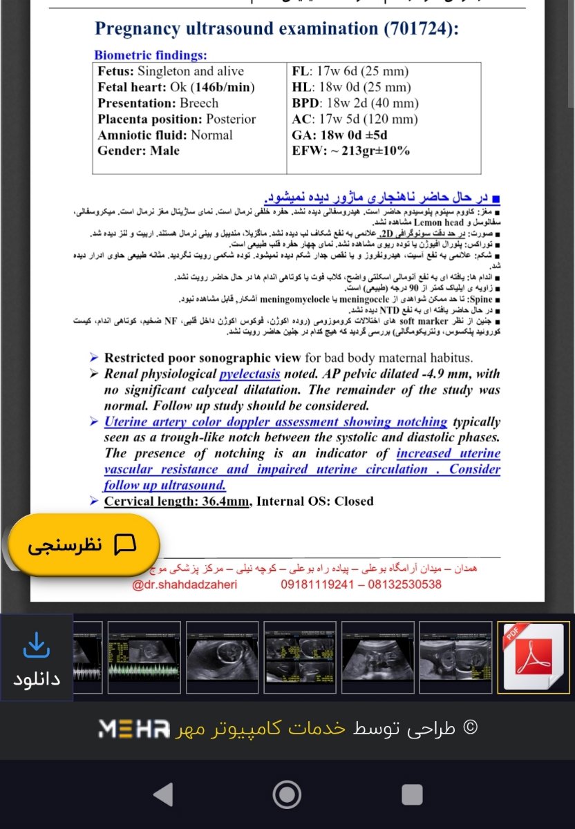 تفسیر سونوی آنومالی اسکن