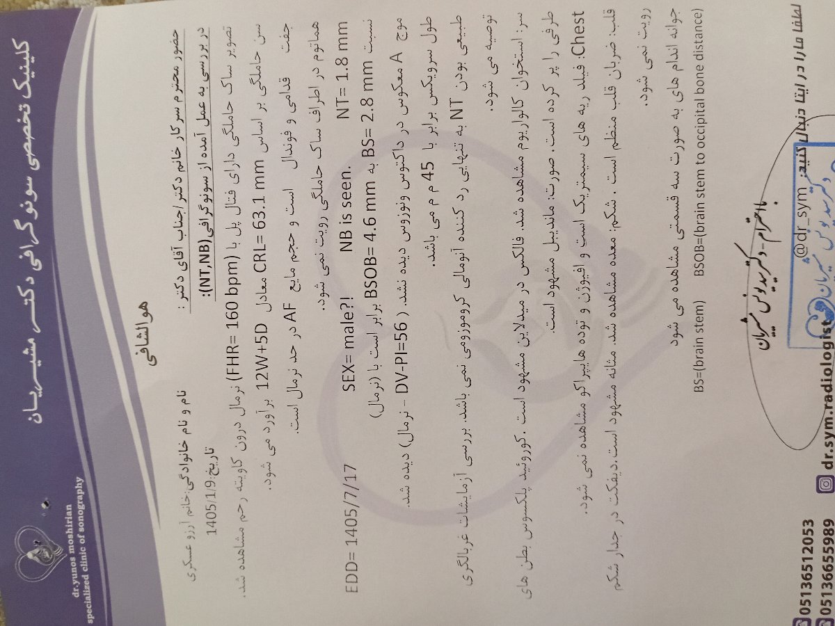 رفتم انتی بیاین حدس بزنین رفتم انتی بیاین حدس بزنین