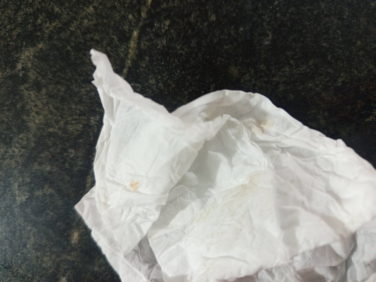 لکه بینی تو هفته ۲۱ بارداری