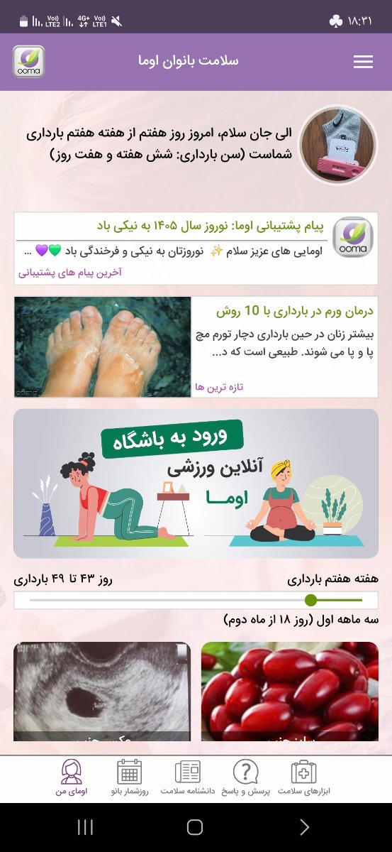 سونوی تشکیل قلب 🥺 سونوی تشکیل قلب 🥺