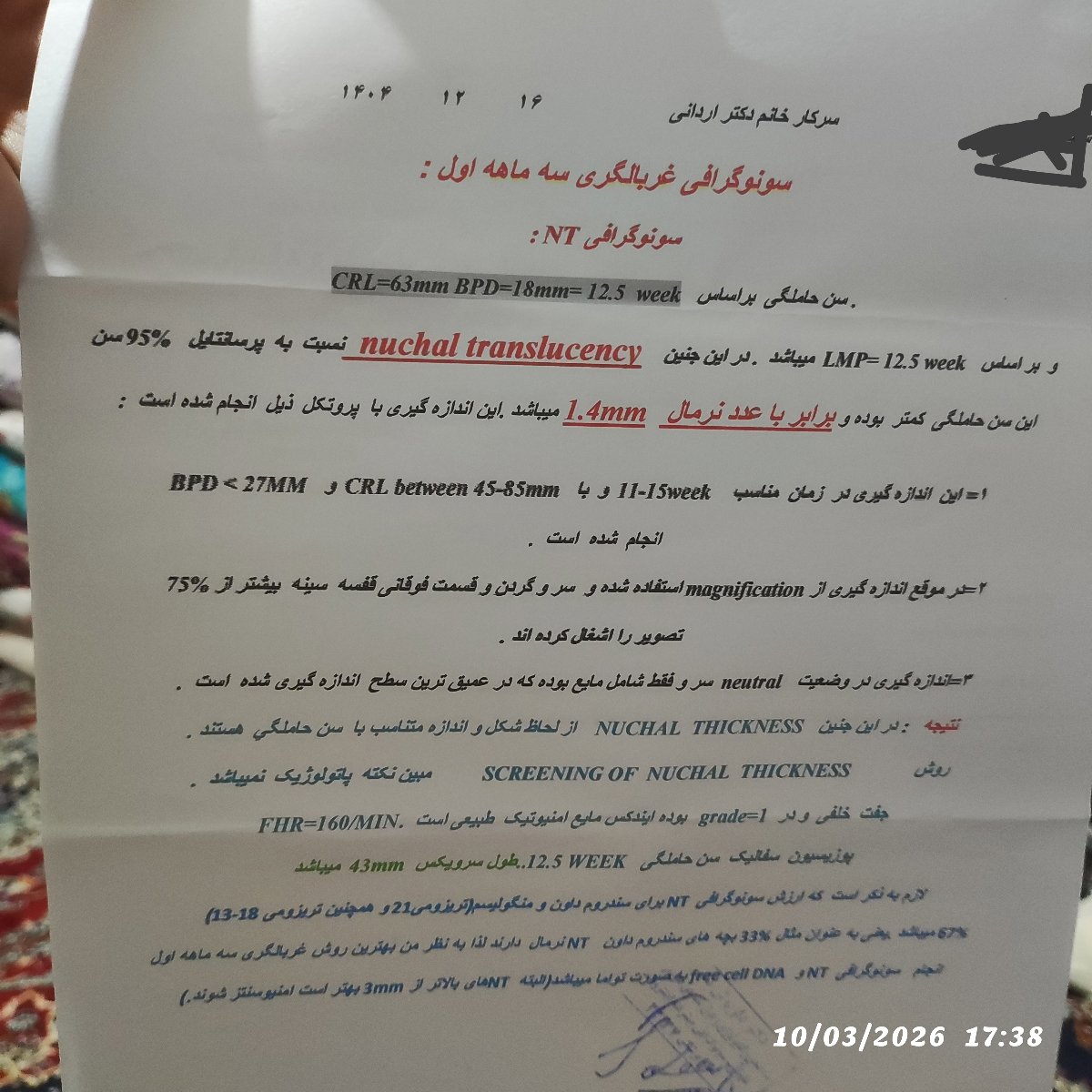 سیاه شدن ناخن دست سیاه شدن ناخن دست