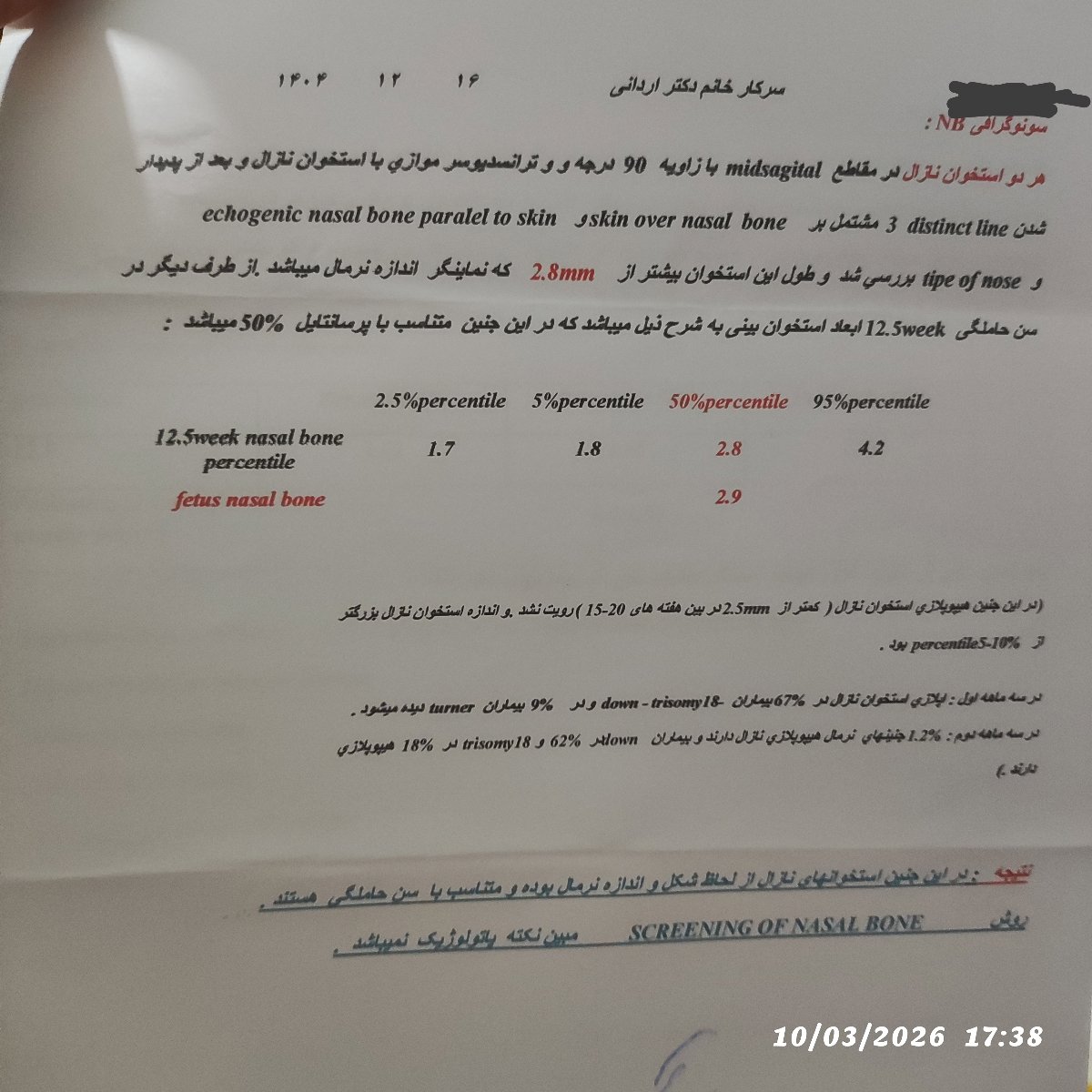 سیاه شدن ناخن دست سیاه شدن ناخن دست