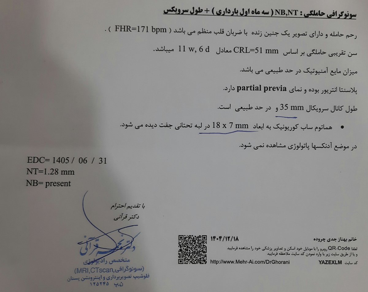 احساس باز شدن و افتادن چیزی از رحم احساس باز شدن و افتادن چیزی از رحم