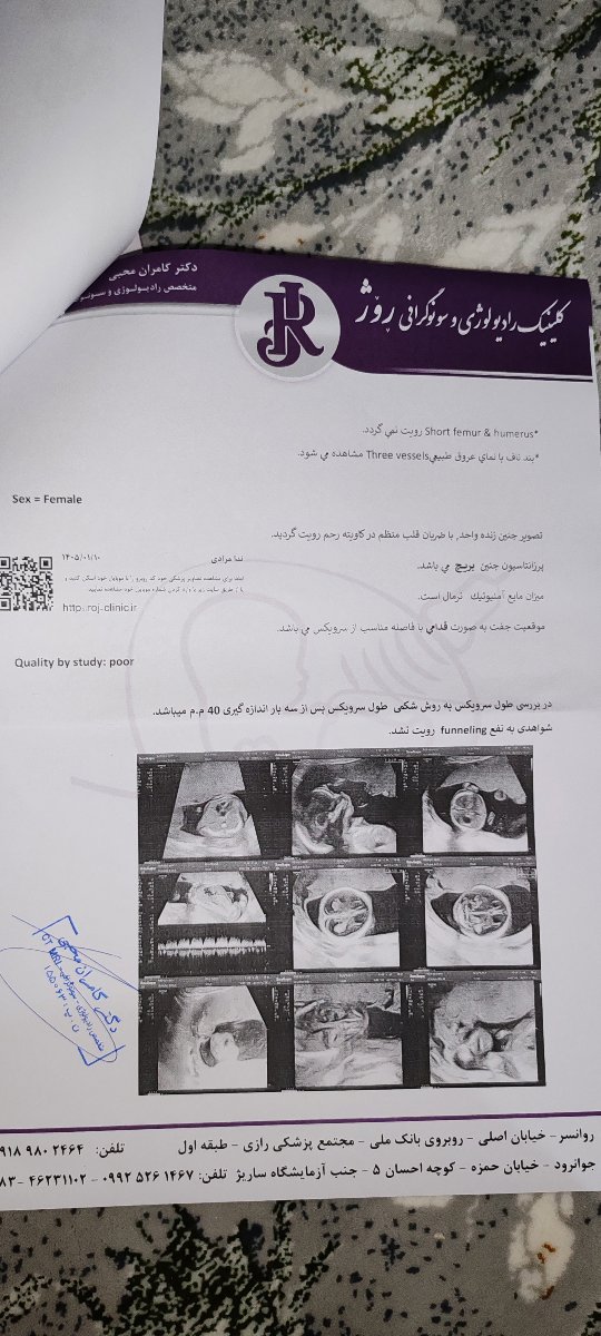 سونو انومالی اسکن 18 هفته