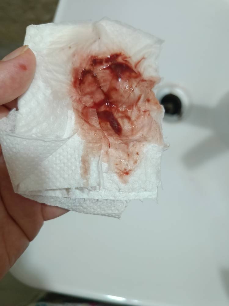 سلام خانم دکتر خونربزی دارم میشه کمک کنین سلام خانم دکتر خونربزی دارم میشه کمک کنین