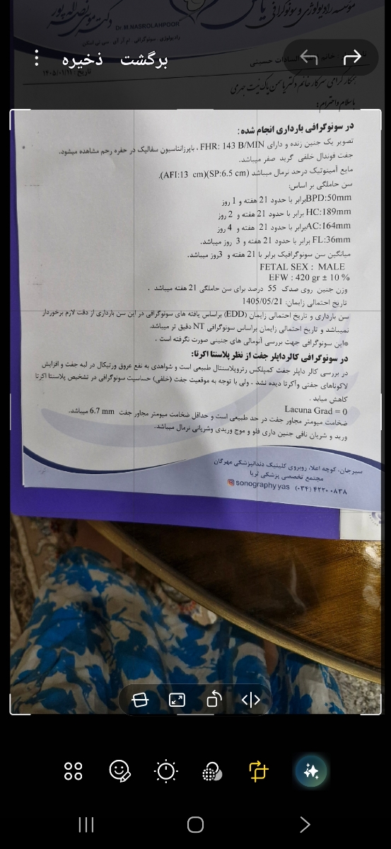 سونوی داپلر و چسبندگی سونوی داپلر و چسبندگی