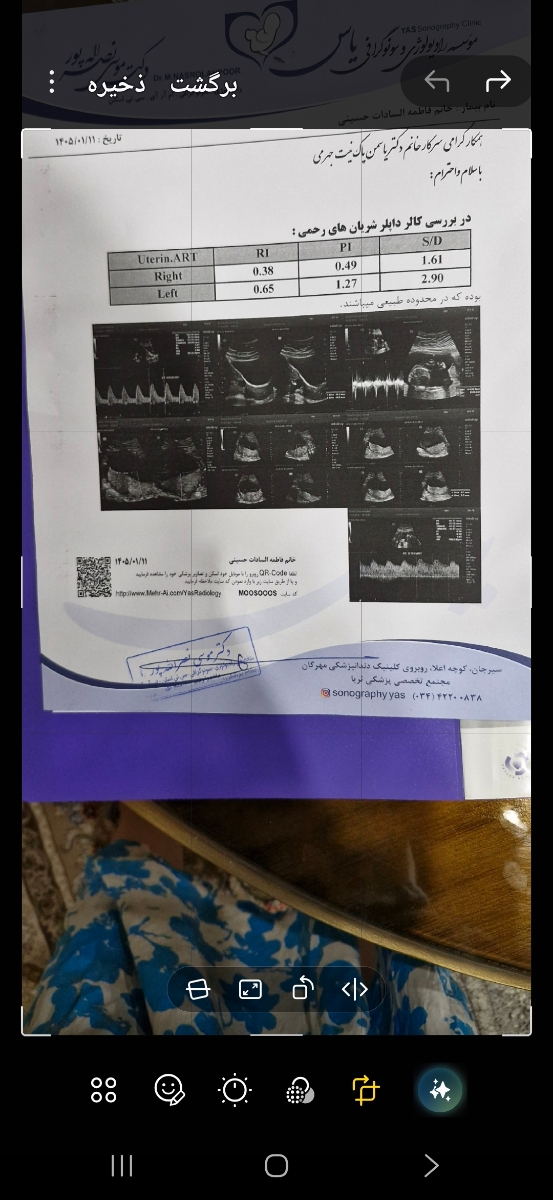 سونوی داپلر و چسبندگی سونوی داپلر و چسبندگی