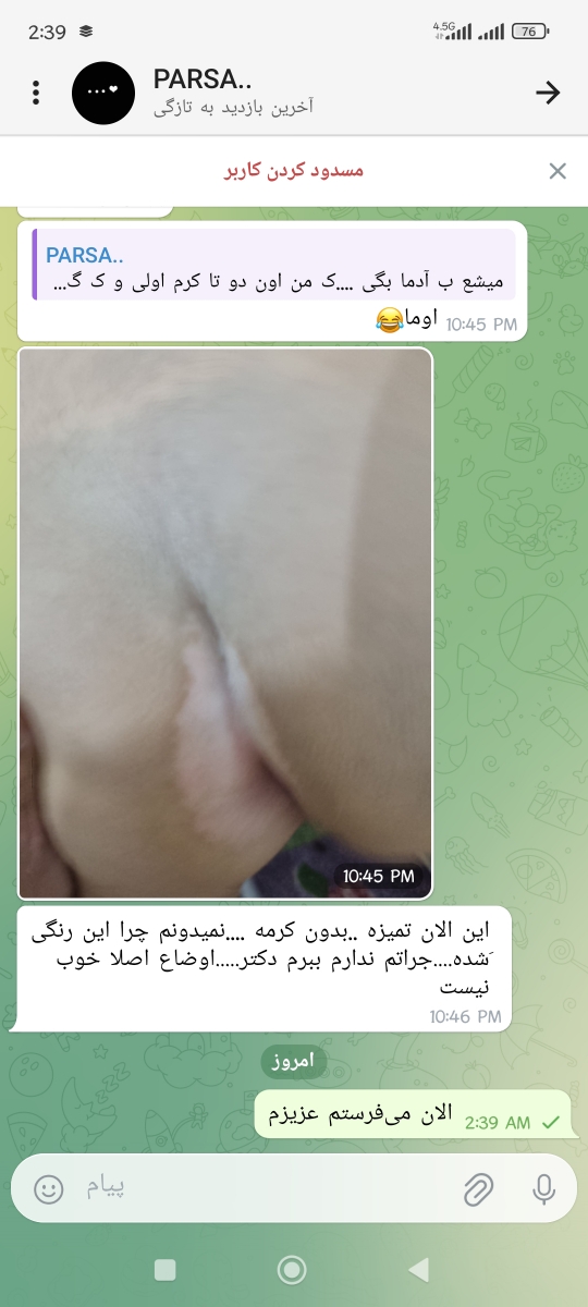 سوختگی پشت بچه یکساله.....حاوی عکس .... سوختگی پشت بچه یکساله.....حاوی عکس ....