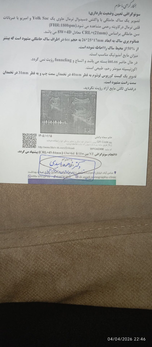 دکتر بعد از سقط رفتم سنو ولی انگار بچه هنوز هست...میشه ببینین راهنمایی کنید دکتر بعد از سقط رفتم سنو ولی انگار بچه هنوز هست...میشه ببینین راهنمایی کنید