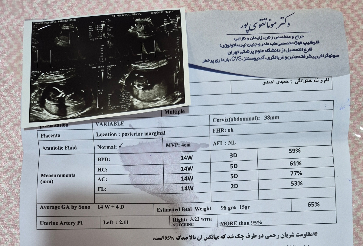 لطفا جواب سونو گرافی لطفا جواب سونو گرافی