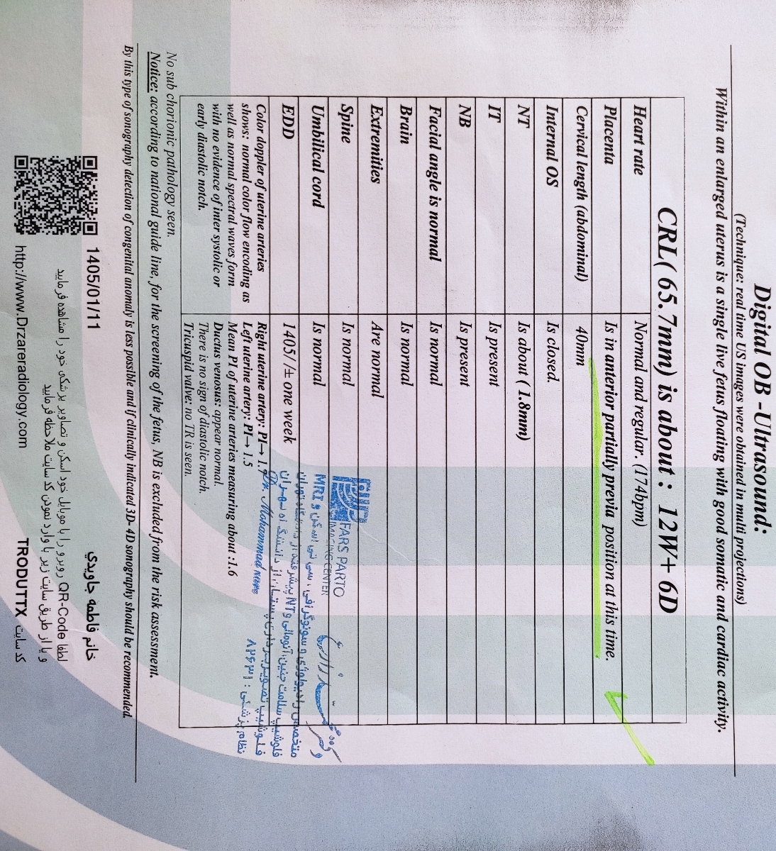 تفسیر سونو و ازمایش ان تی تفسیر سونو و ازمایش ان تی