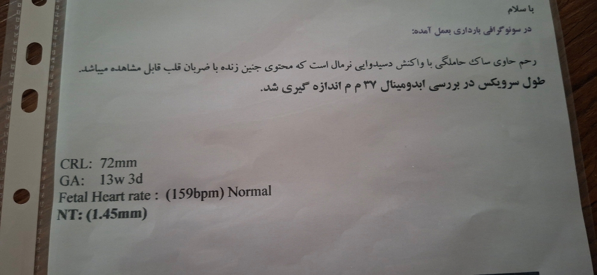 تفسیر سونوی ان تی