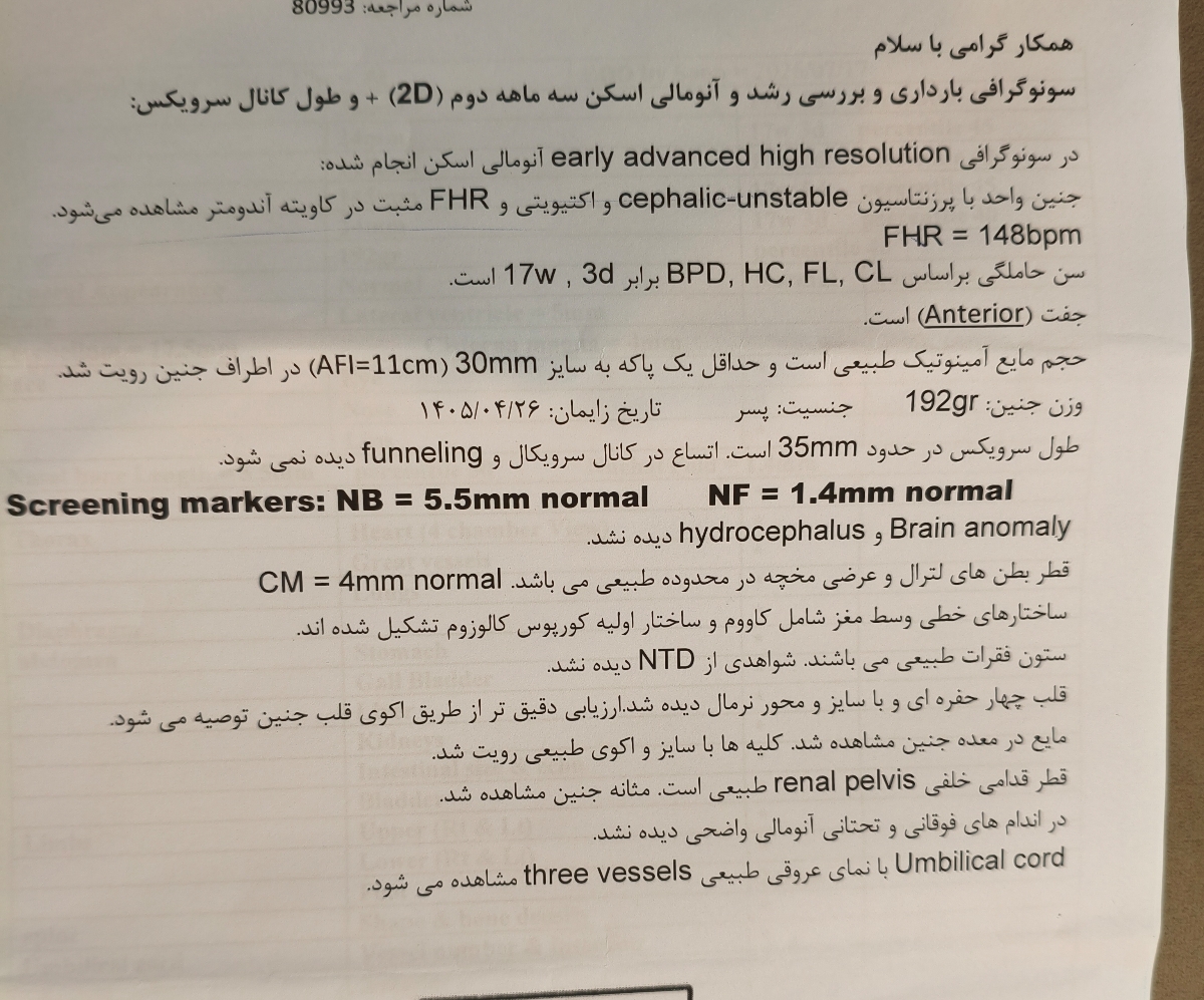 آنومالی ۲۱بهمن ماه آنومالی ۲۱بهمن ماه