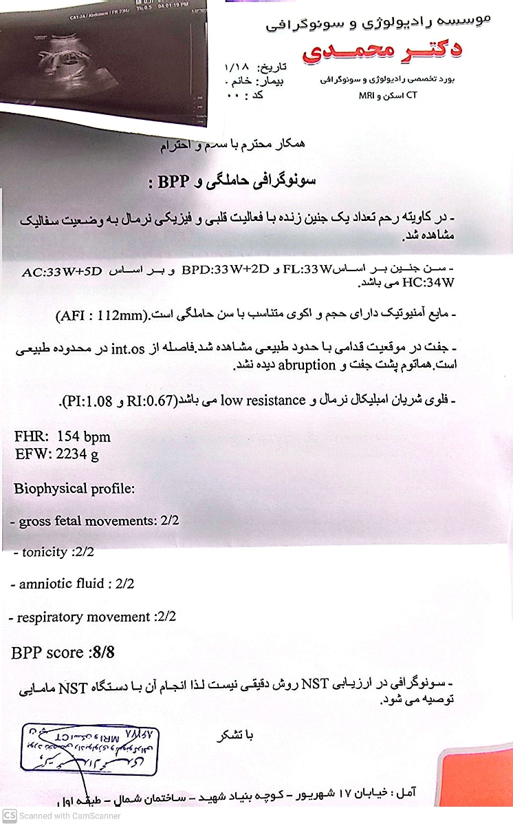 تفسیر سونو وزن و بایوفیزیکال تفسیر سونو وزن و بایوفیزیکال