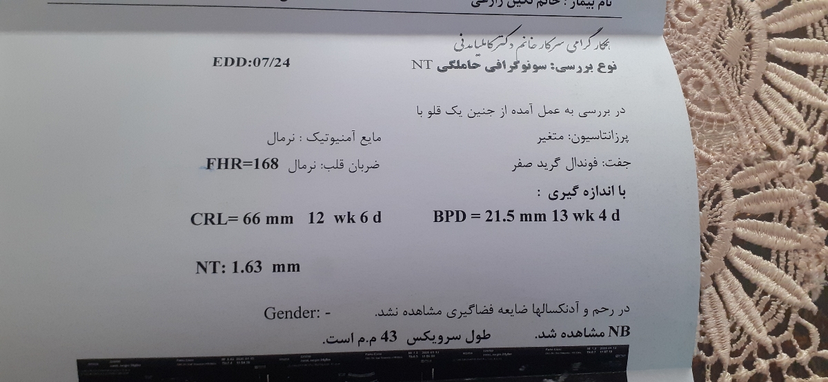 بررسی سونوگرافی ان تی و تفسیر