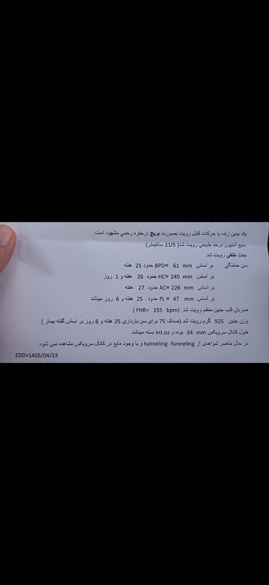 وزن جنین صدک ۷۵