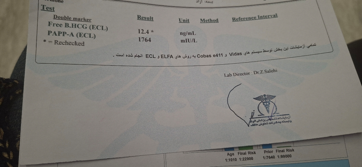 تفسیر سونوی ان تی
