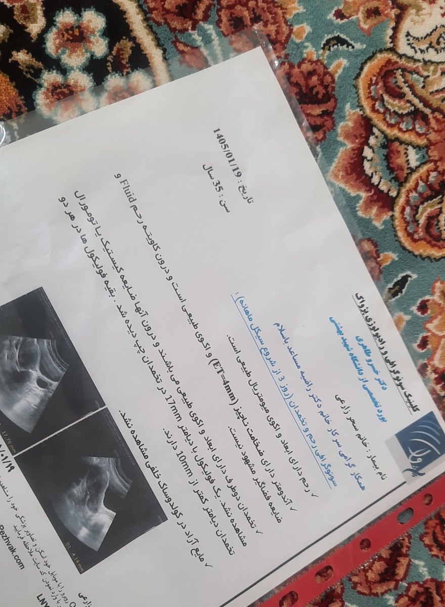 این سونومه