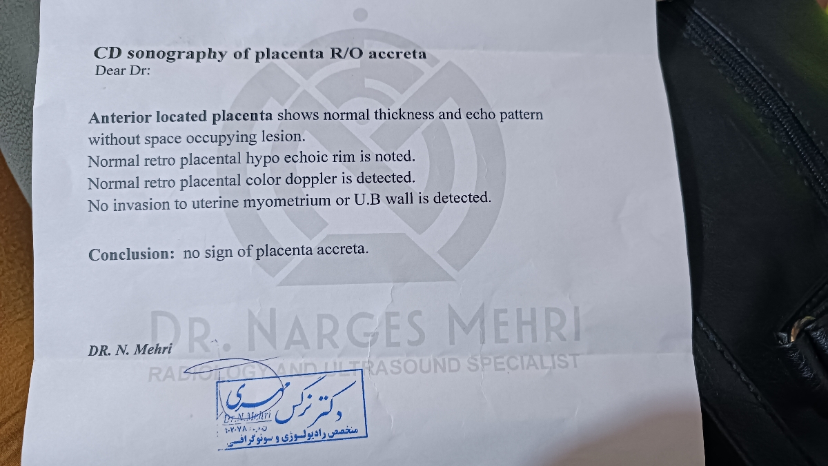 فشار و دفع پروتیین