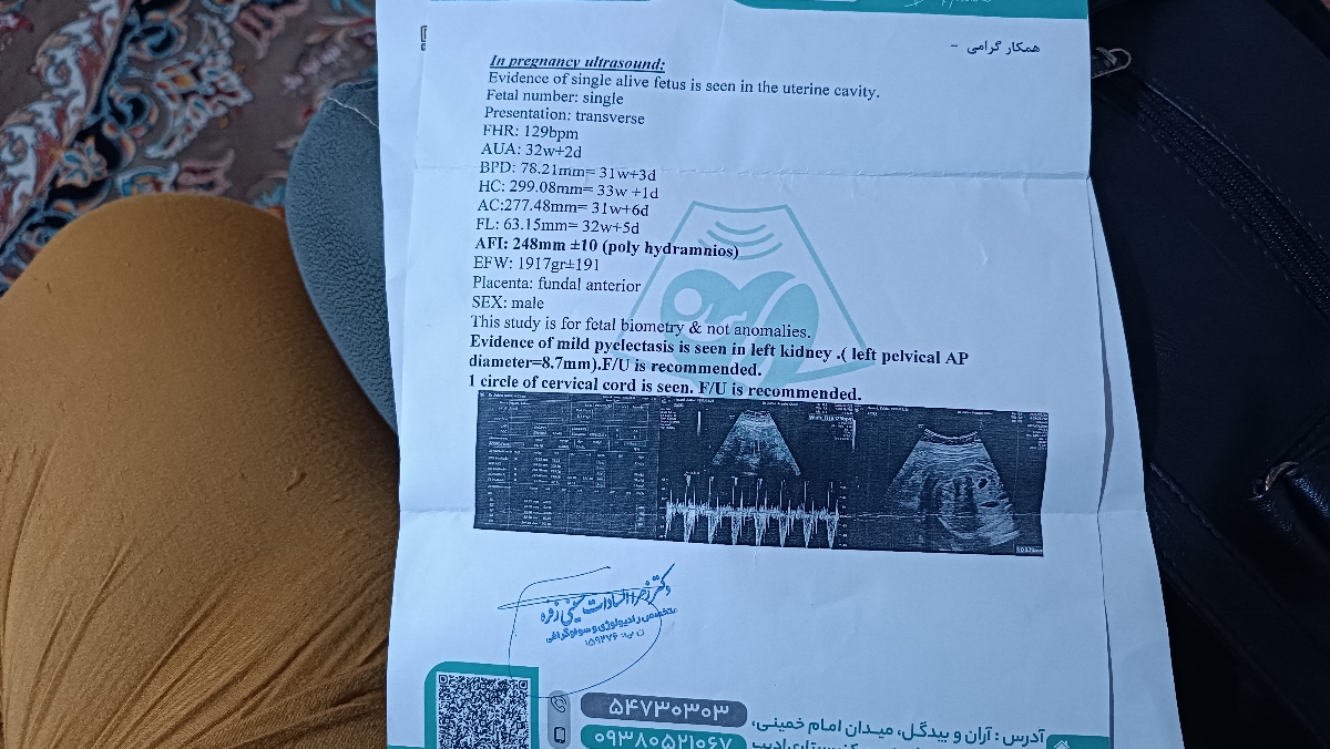 فشار و دفع پروتیین