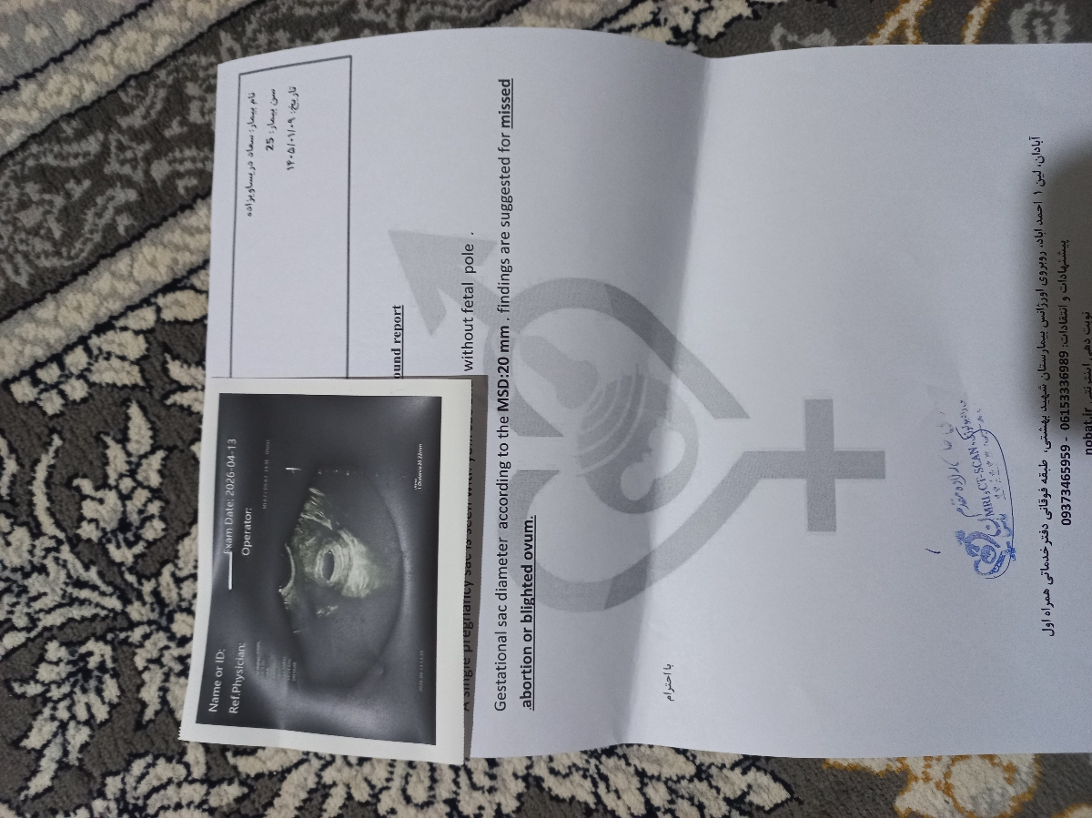 سونو بارداری پوچ لطفا جواب بدید