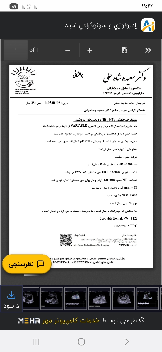 آزمایش nt و تفسیر ان آزمایش nt و تفسیر ان