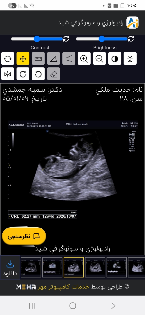 آزمایش nt و تفسیر ان آزمایش nt و تفسیر ان