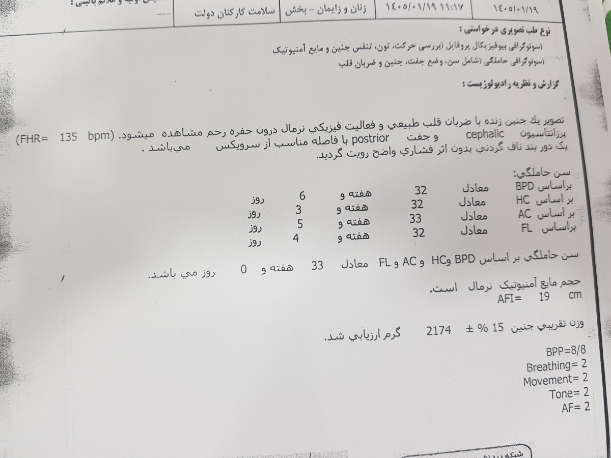 لطفا سونو رو تفسیر کنید و تجربیاتتون رو بگید🙏 لطفا سونو رو تفسیر کنید و تجربیاتتون رو بگید🙏