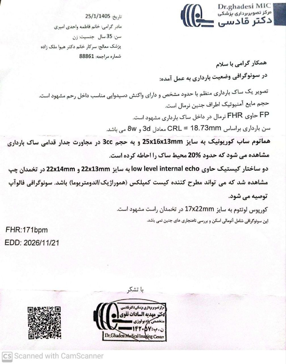 اینم نتیجه سونو