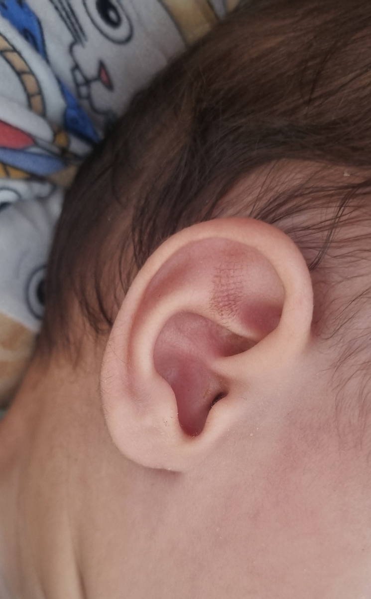 تیره شدن گوش پسرم