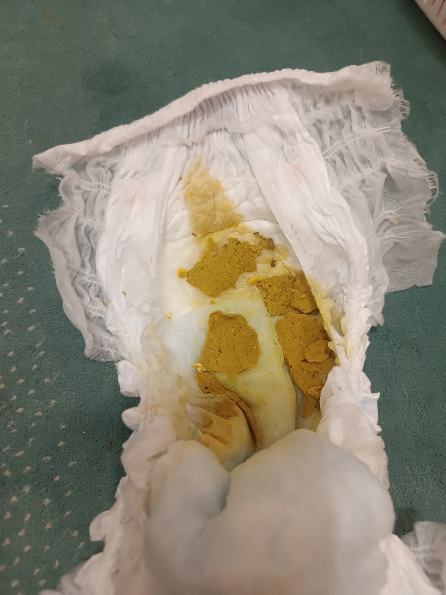 اسهال کو دک یکساله اسهال کو دک یکساله