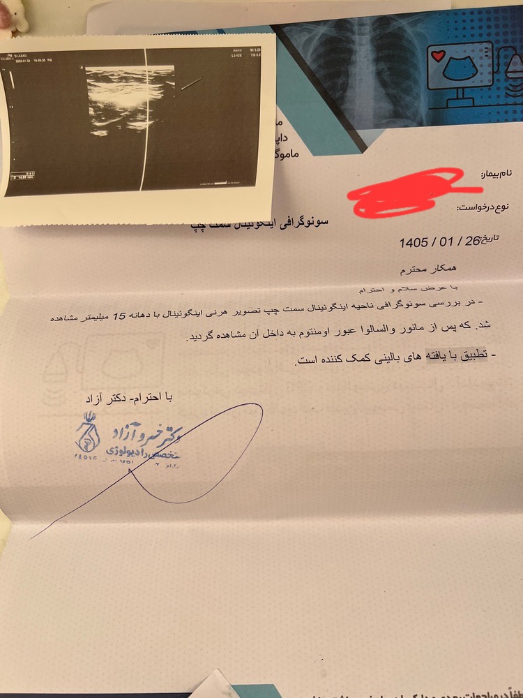 اقدام به بارداری و فتق شکم اقدام به بارداری و فتق شکم