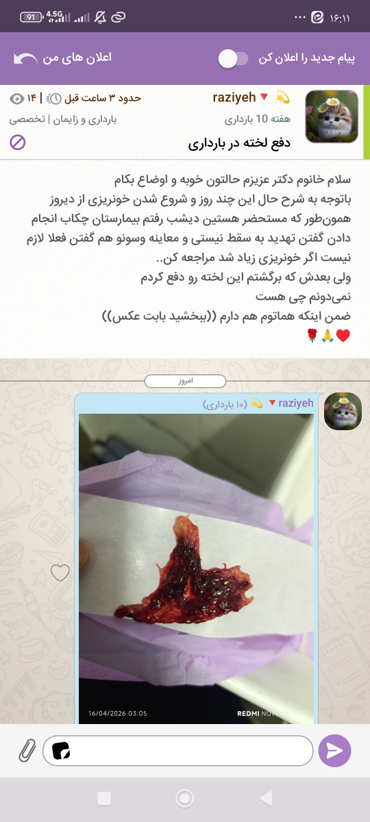 سلام پشتیبانی عزیز میشه لطفا به دکتر اطلاع بدین این تاپیک من رو زودتر پاسخ بدن ممنون از مهربونی شما سلام پشتیبانی عزیز میشه لطفا به دکتر اطلاع بدین این تاپیک من رو زودتر پاسخ بدن ممنون از مهربونی شما