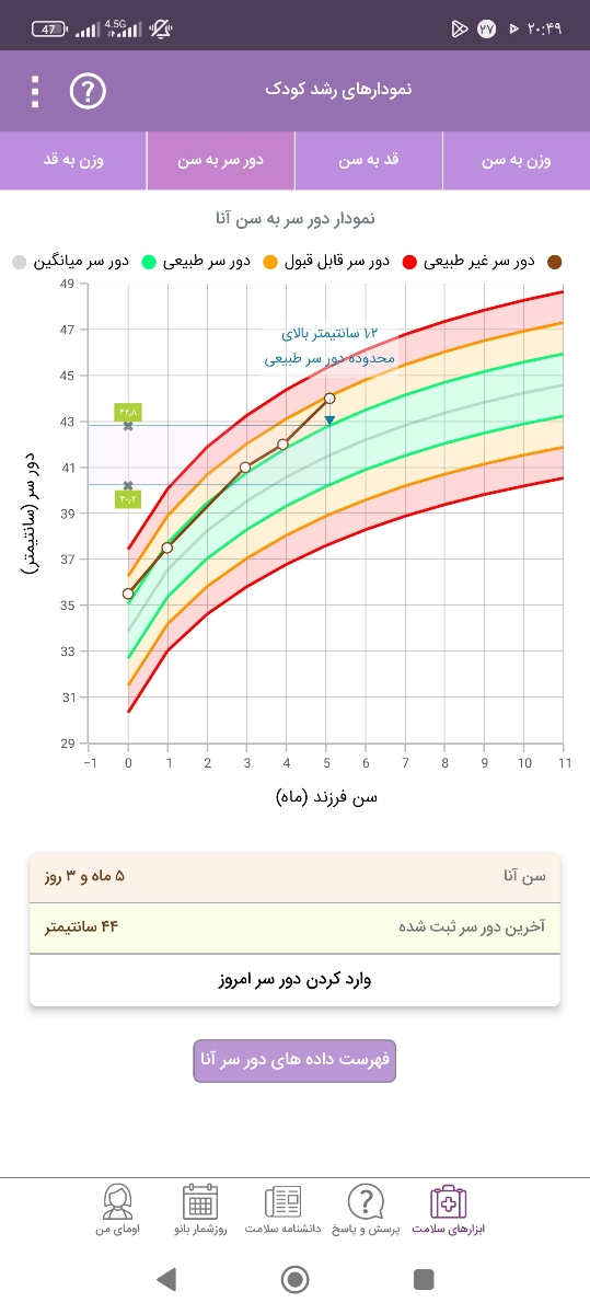 دور سر نوزاد باید چقدر باشه