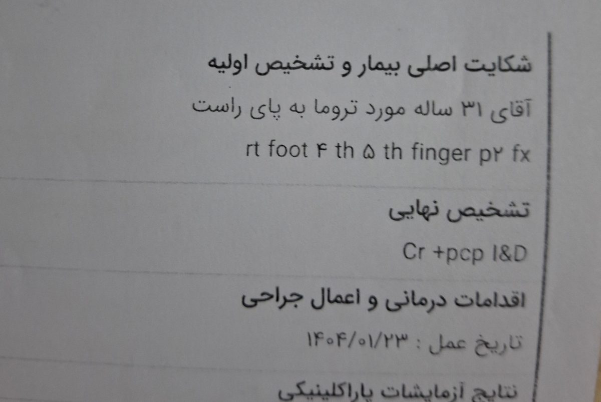 دیه انگشت دوتا انگشت پا دیه انگشت دوتا انگشت پا