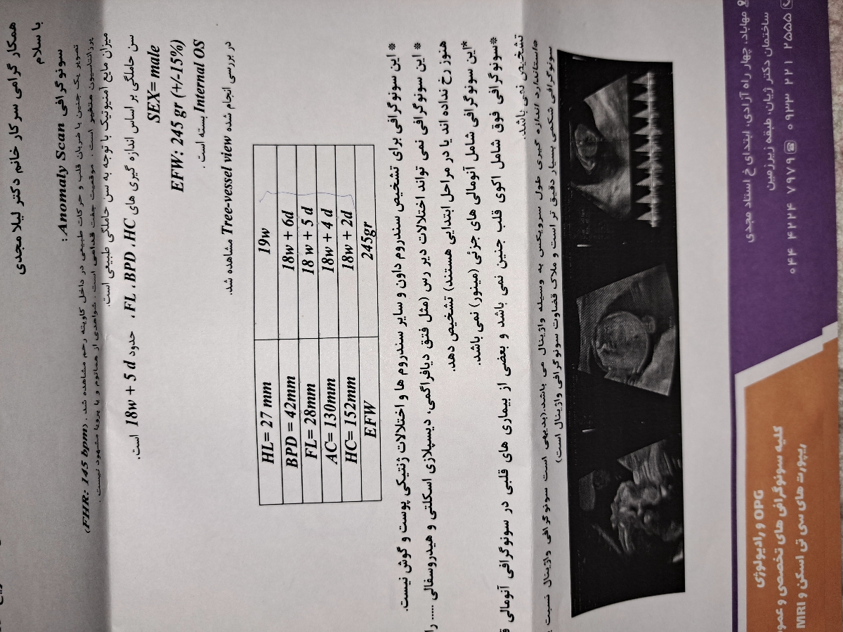 بارداری، درد شکمی، هفته بیست و یکم بارداری، درد شکمی، هفته بیست و یکم