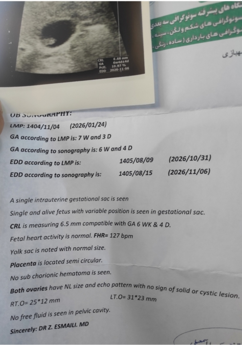 سقط جنین در هفته یازدهم سقط جنین در هفته یازدهم