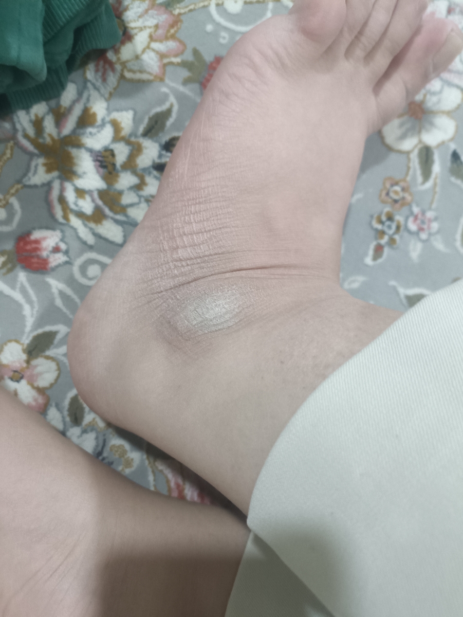 برای خشکی پوست پا چه کرمی استفاده کنم