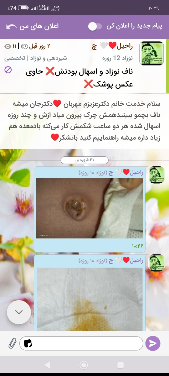 سلام پشتیبانی گرامی
میشه این تاپیکم رو دکتر ببینه دو روز گذشته سلام پشتیبانی گرامی
میشه این تاپیکم رو دکتر ببینه دو روز گذشته
