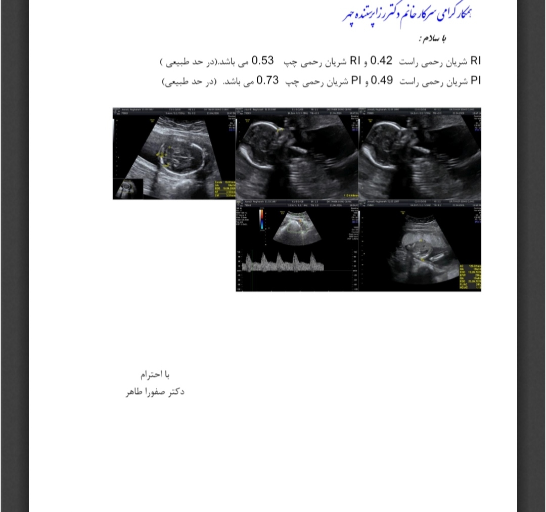 سونوگرافی آنومالی . .