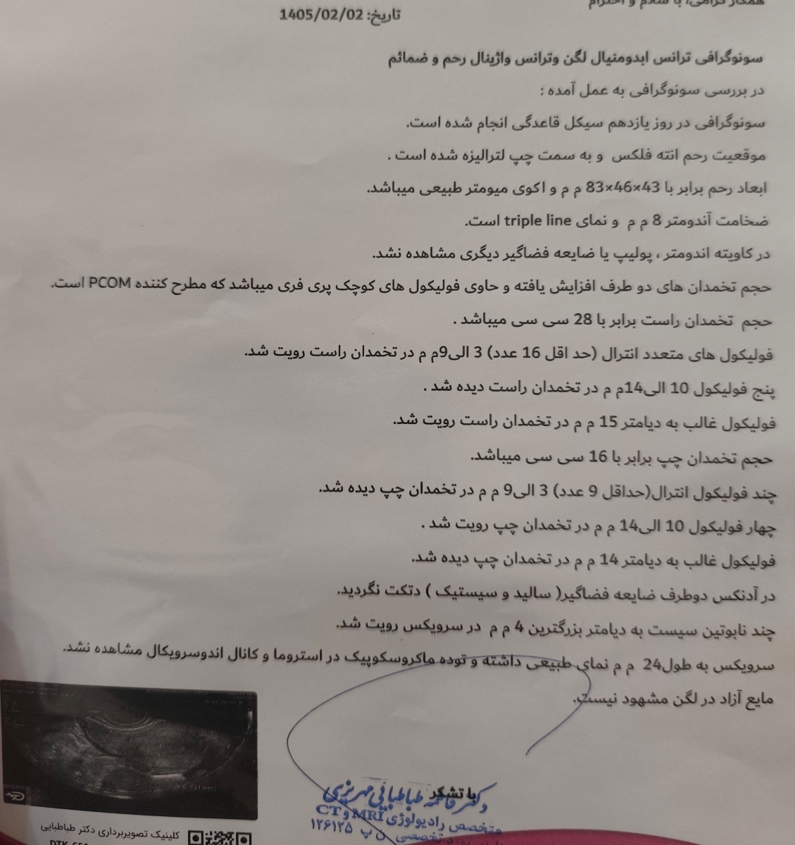 سونو روز ۱۱ قاعدگی